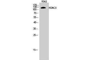 Western Blotting (WB) image for anti-Histone Deacetylase 5 (HDAC5) (Tyr512) antibody (ABIN3184988) (HDAC5 antibody  (Tyr512))