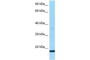 WB Suggested Anti-LY6G5B Antibody Titration: 1. (LY6G5B antibody  (N-Term))