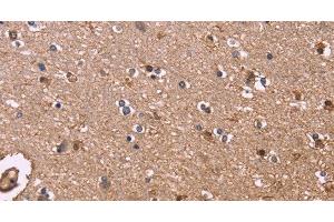 Immunohistochemistry of paraffin-embedded Human brain tissue using S100A13 Polyclonal Antibody at dilution 1:40 (S100A13 antibody)