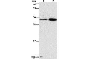 Western blot analysis of Hela and A431 cell, using CDC34 Polyclonal Antibody at dilution of 1:900