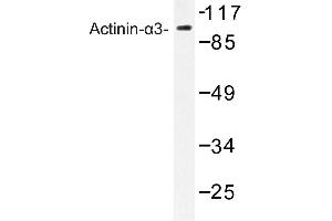 Image no. 1 for anti-Actinin, alpha 3 (ACTN3) antibody (ABIN272284) (ACTN3 antibody)