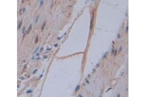 Figure. (Annexin A3 antibody  (AA 190-312))
