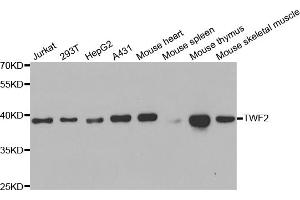 Western blot analysis of extracts of various cell lines, using TWF2 antibody. (TWF2 antibody)