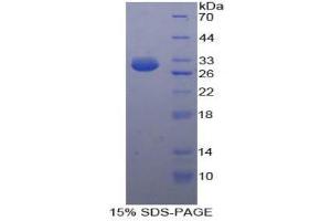 SDS-PAGE (SDS) image for Hexokinase 3 (White Cell) (HK3) (AA 673-903) protein (His tag) (ABIN2125190) (HK3 Protein (AA 673-903) (His tag))