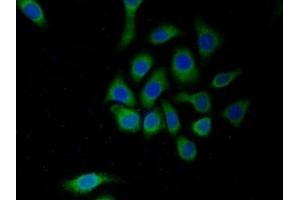 Detection of MAOA in Human HepG2 cell using Polyclonal Antibody to Monoamine Oxidase A (MAOA) (Monoamine Oxidase A antibody  (AA 229-428))