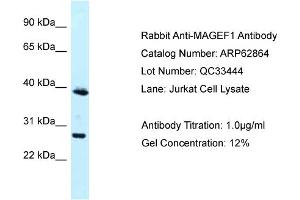 Western Blotting (WB) image for anti-Melanoma Antigen Family F, 1 (MAGEF1) (N-Term) antibody (ABIN2789273) (MAGEF1 antibody  (N-Term))