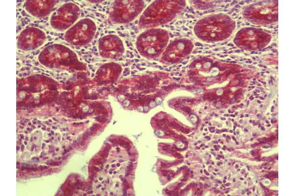 RILPL1 antibody  (N-Term)