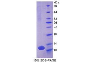 SDS-PAGE (SDS) image for Defensin, beta 103A (DEFB103A) (AA 23-67) protein (His tag) (ABIN2124602) (DEFB103A Protein (AA 23-67) (His tag))