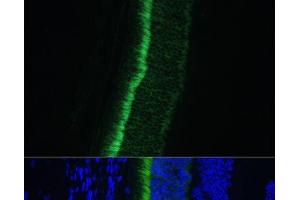 Immunofluorescence analysis of Mouse eye using GNGT1 Polyclonal Antibody at dilution of 1:100 (40x lens). (GNGT1 antibody)