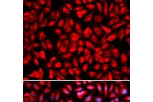 Immunofluorescence analysis of U2OS cells using IPO5 Polyclonal Antibody (Importin 5 antibody)