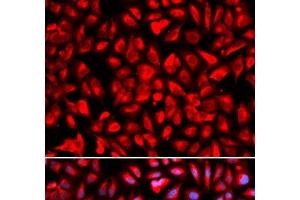 Immunofluorescence analysis of U2OS cells using IPO5 Polyclonal Antibody (Importin 5 antibody)