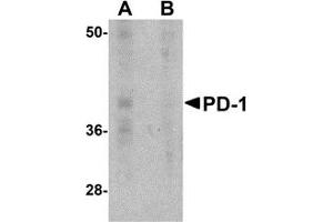 Western Blotting (WB) image for anti-Programmed Cell Death 1 (PDCD1) antibody (ABIN1031789) (PD-1 antibody)