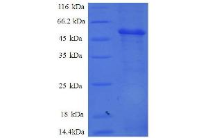 Proteasome Subunit alpha  7 (PSMA7) (AA 44-275), (partial) protein (GST tag)