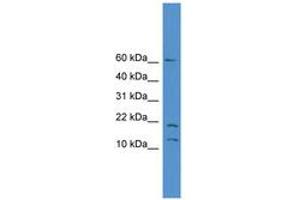 Image no. 1 for anti-Small Nuclear RNA Activating Complex, Polypeptide 5, 19kDa (SNAPC5) (AA 10-59) antibody (ABIN6745419) (SNAPC5 antibody  (AA 10-59))