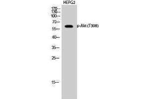 Western Blotting (WB) image for anti-V-Akt Murine Thymoma Viral Oncogene Homolog 1 (AKT1) (pThr308) antibody (ABIN3182380) (AKT1 antibody  (pThr308))
