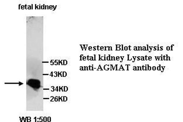 AGMAT antibody  (Internal Region)