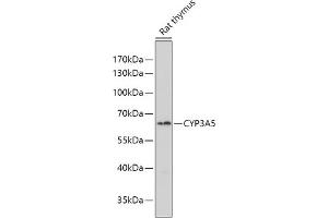 Western blot analysis of extracts of Rat thymus, using CYP3 antibody (ABIN6130166, ABIN6139354, ABIN6139355 and ABIN6223584) at 1:1000 dilution. (CYP3A5 antibody  (AA 233-502))
