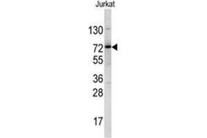 Western blot analysis of NKRF antibody (Center) in Jurkat cell line lysates (35ug/lane).