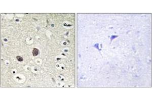 Immunohistochemistry analysis of paraffin-embedded human brain tissue, using TIE2 (Ab-1102) Antibody. (TEK antibody  (AA 1068-1117))