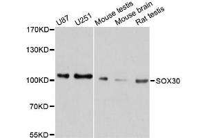 Western blot analysis of extracts of various cell lines, using SOX30 antibody (ABIN5998922) at 1/1000 dilution. (SOX30 antibody)