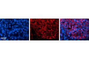 Rabbit Anti-SH3BGRL Antibody     Formalin Fixed Paraffin Embedded Tissue: Human Pineal Tissue  Observed Staining: Cytoplasmic in cell bodies of pinealocytes  Primary Antibody Concentration: 1:100  Other Working Concentrations: 1/600  Secondary Antibody: Donkey anti-Rabbit-Cy3  Secondary Antibody Concentration: 1:200  Magnification: 20X  Exposure Time: 0. (SH3BGRL antibody  (Middle Region))