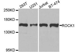Western blot analysis of extracts of various cell lines, using ROCK1 antibody.