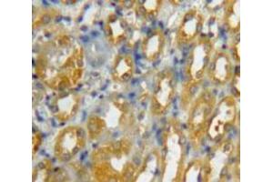 Used in DAB staining on fromalin fixed paraffin-embedded Kidney tissue (CCL8 antibody  (AA 1-99))