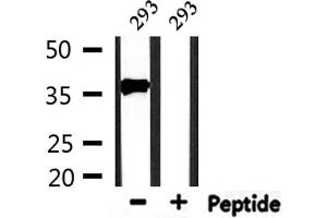 Western Blotting (WB) image for anti-PDZ and LIM Domain 1 (PDLIM1) (Internal Region) antibody (ABIN6264117)