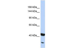 Host:  Rabbit  Target Name:  NFKB2  Sample Type:  Jurkat Whole cell lysates  Antibody Dilution:  1.