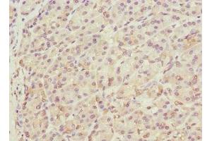 Immunohistochemistry of paraffin-embedded human pancreatic tissue using ABIN7172143 at dilution of 1:100 (THADA antibody  (AA 1684-1953))
