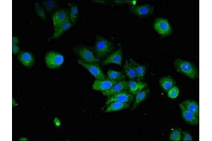 Immunofluorescent analysis of HepG2 cells using ABIN7156659 at dilution of 1:100 and Alexa Fluor 488-congugated AffiniPure Goat Anti-Rabbit IgG(H+L) (IFI44L antibody  (AA 206-307))