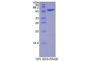 SDS-PAGE (SDS) image for Apolipoprotein B (APOB) (AA 331-511) protein (His tag,GST tag) (ABIN2122427)