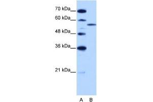 Human HepG2; WB Suggested Anti-ZRSR2 Antibody Titration: 2. (ZRSR2 antibody  (C-Term))