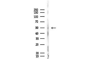 anti-Cytokine Receptor-Like Factor 3 (CRLF3) (Internal Region) antibody