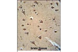 Paraformaldehyde-fixed, paraffin embedded Human brain tissue, Antigen retrieval by boiling in sodium citrate buffer (pH6. (ALDH2 antibody)