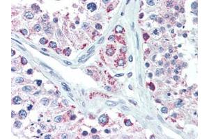 Human Testis (formalin-fixed, paraffin-embedded) stained with LIN28Bfollowed by biotinylated goat anti-rabbit IgG secondary antibody, alkaline phosphatase-streptavidin and chromogen. (LIN28B antibody  (N-Term))