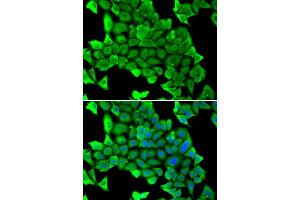 Immunofluorescence analysis of U2OS cells using MYH1 antibody (ABIN5974170). (MYH1 antibody)