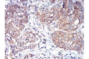 Immunohistochemistry (IHC) image for anti-RAB1B, Member RAS Oncogene Family (RAB1B) (AA 60-201) antibody (ABIN5875927) (RAB1B antibody  (AA 60-201))