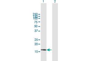 Western Blot analysis of SRP19 expression in transfected 293T cell line by SRP19 MaxPab polyclonal antibody.