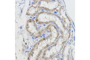 Immunohistochemistry of paraffin-embedded Mouse kidney using CYP51 Rabbit pAb (3485) at dilution of 1:50 (40x lens). (CYP51A1 antibody  (AA 210-509))