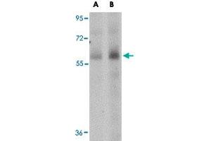 Western blot analysis of SCARB1 in human spleen tissue lysate with SCARB1 polyclonal antibody  at (A) 1 and (B) 2 ug/mL . (SCARB1 antibody  (N-Term))