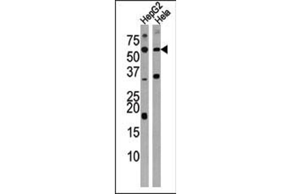ACVR1C/ALK7 antibody  (N-Term)