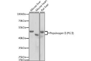 Western blot analysis of extracts of various cell lines, using Pepsinogen II (PG II) antibody (ABIN3016694, ABIN3016695, ABIN3016696 and ABIN6219816) at 1:1000 dilution.