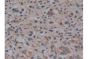 Immunohistochemistry (IHC) image for anti-Microfibrillar Associated Protein 2 (MFAP2) (AA 6-162) antibody (ABIN7442855)