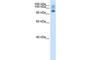 Western Blotting (WB) image for anti-Splicing Factor, Suppressor of White-Apricot Homolog (SFSWAP) antibody (ABIN2462165)
