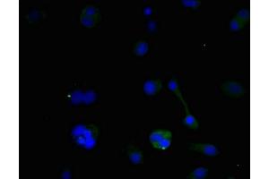 Immunofluorescent analysis of MCF-7 cells using ABIN7145331 at dilution of 1:100 and Alexa Fluor 488-congugated AffiniPure Goat Anti-Rabbit IgG(H+L) (BNIP3 antibody  (AA 1-164))