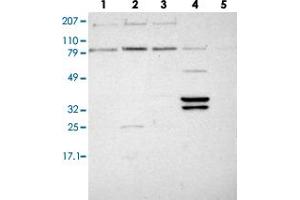Western blot analysis of lane 1: RT-4, lane 2: EFO-21, lane 3: A-431, lane 4: Liver and lane 5: Tonsi lusing PLEK2 polyclonal antibody .
