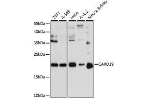 Western blot analysis of extracts of various cell lines, using CARD19 antibody (ABIN6290304) at 1:3000 dilution. (C9orf89 antibody)