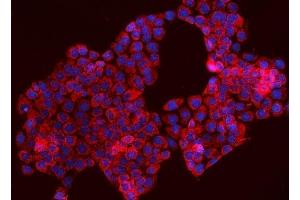 IF analysis of TOMM70 using anti-TOMM70 antibody (ABIN7599855). (TOM70 antibody  (AA 122-608))