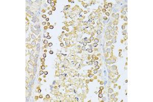 Immunohistochemistry of paraffin-embedded mouse testis using MAP1LC3B antibody (ABIN6291773) at dilution of 1:100 (40x lens).